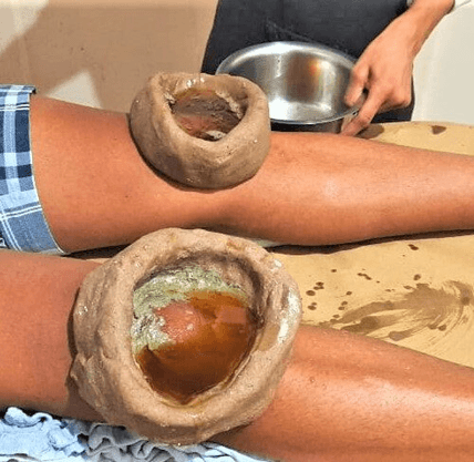 Department of Panchakarma - About image 2