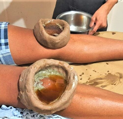 Department of Panchakarma - About image 2