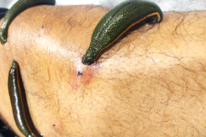 Department of Panchakarma - Key area 2